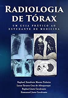 Radiologia de Tórax : um guia ao estudante de medicina
