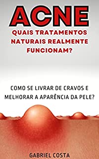 Livro Acne - Quais tratamentos naturais realmente funcionam?: Como se livrar de cravos e melhorar a aparência da pele? (Saúde, Beleza, Dieta)