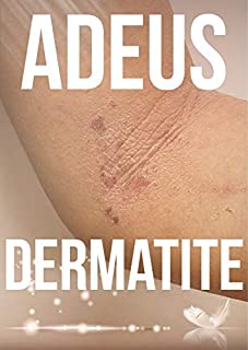 Livro Adeus Dermatite: Acabe com essa Condição de Pele Desagradável