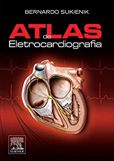 Atlas de Eletrocardiografia