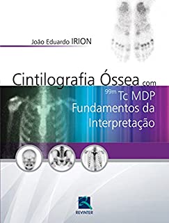 Cintilografia óssea com 99mTc MDP: Fundamentos da interpretação