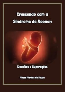 Livro Crescendo com a Síndrome de Noonan: Desafios e Superações