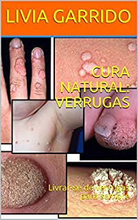 Livro CURA NATURAL: VERRUGAS: Livrar-se de verrugas para sempre