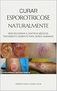 Livro Curar Esporotricose Naturalmente: Sem Recorrer a Centros Médicos, Tratamento Somente Para Seres Humanos