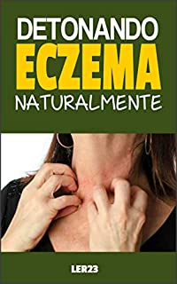 Livro Detonando Eczema: Dicas Eficientes Para Detonar Eczema de Forma Natural (Saúde Mais Livro 2)