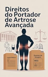 Livro Direitos do Portador de Artrose Avançada