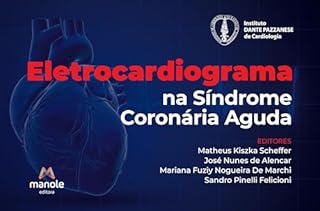 Eletrocardiograma na síndrome coronária aguda