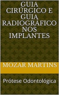 Livro Guia Cirúrgico e Guia Radiográfico nos Implantes: Prótese Odontológica
