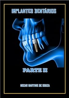 Livro IMPLANTES DENTÁRIOS: PARTE II