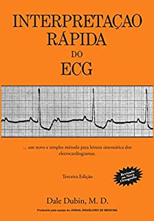 Interpretação Rápida do ECG