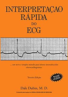 Interpretação Rápida do ECG