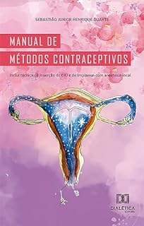 Manual de métodos contraceptivos: inclui técnica de inserção do DIU e do Implanon com anestesia local