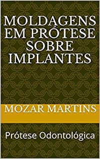 Livro Moldagens em Prótese sobre Implantes: Prótese Odontológica