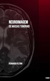 Livro Neuroimagem de Massas Tumorais: Fernando Feltrin