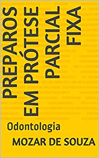 Livro Preparos em Prótese Parcial Fixa: Odontologia