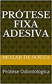 Livro Prótese Fixa Adesiva: Prótese Odontológica