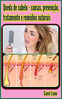 Livro Queda de cabelo - causas, prevenção, tratamento e remédios naturais