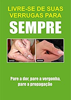 Livro Como Remover Verrugas Rapidamente de Forma Natural Para Sempre