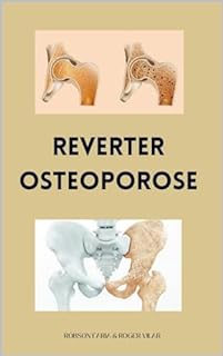 Livro Reverter Osteoporose Naturalmente (Método Natural Que Ajuda No Fortalecimento Ósseo e Na Reversão Da Degeneração)