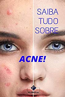 Livro Saiba Tudo Sobre ACNE!