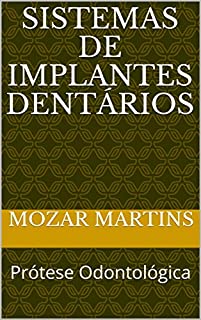 Livro Sistemas de Implantes Dentários: Prótese Odontológica