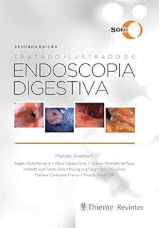 Livro Tratado Ilustrado de Endoscopia Digestiva