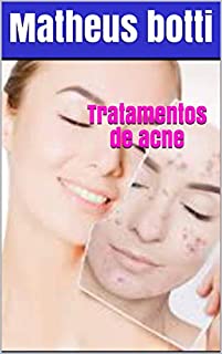 Livro Tratamentos de acne