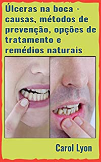 Úlceras na boca - causas, métodos de prevenção, opções de tratamento e remédios naturais