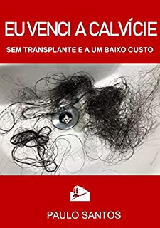 Livro Eu venci a calvície : Sem transplante capilar e a um baixo custo